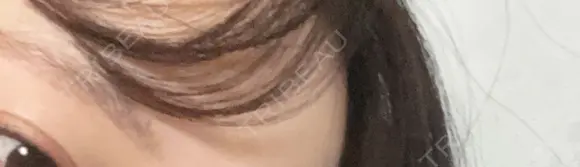 アートメイク（眉） メディカルアートメイク大阪 BEFORE メイン用