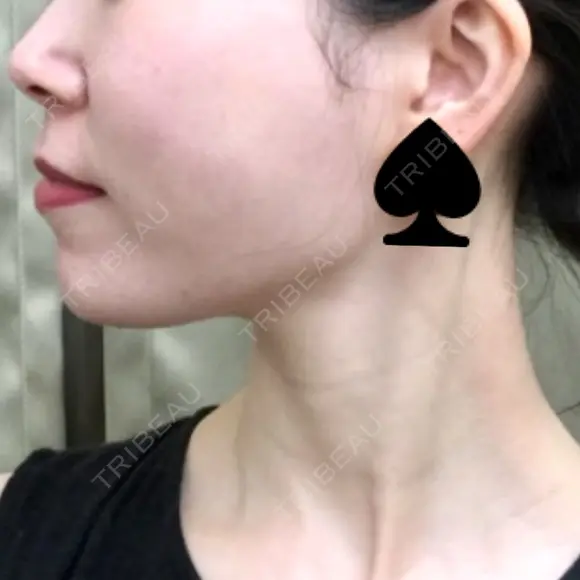 ヒアルロン酸注入（首） 湘南美容クリニック 京都院 BEFORE メイン用