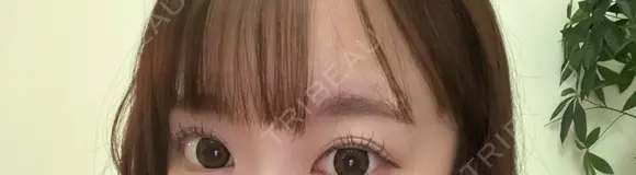 アートメイク（眉） 東京イセアクリニック BEFORE メイン用