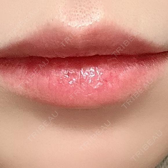 ヒアルロン酸注入（唇） NARU Beauty Clinic 【ナルクリ】 BEFORE メイン用