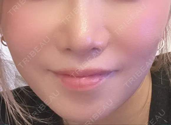 ルメッカ 豊洲内科・糖尿病 / 形成・美容外科クリニック BEFORE メイン用