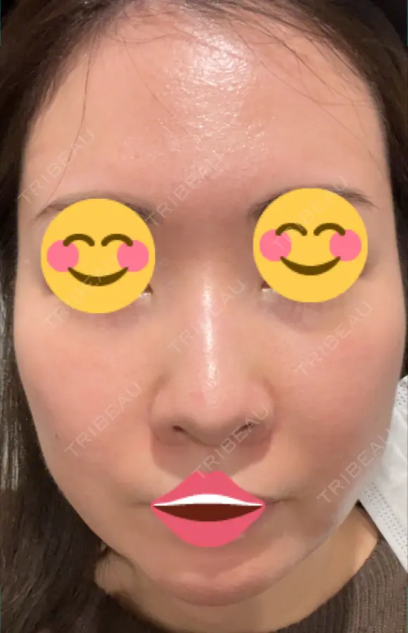 ポテンツァ 9BeautyClinic BEFORE メイン用