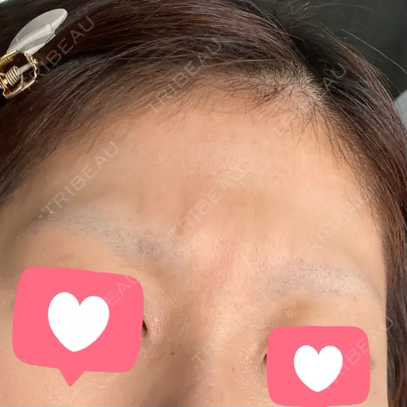 アートメイク（眉） LEAGRANT CLINIC 中目黒 BEFORE メイン用