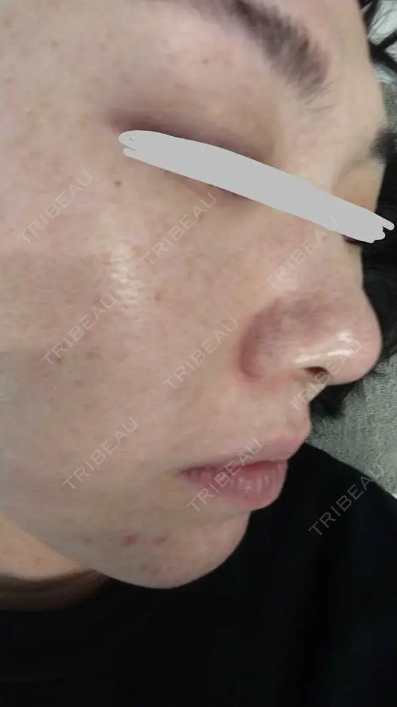 ポテンツァ 9BeautyClinic BEFORE メイン用