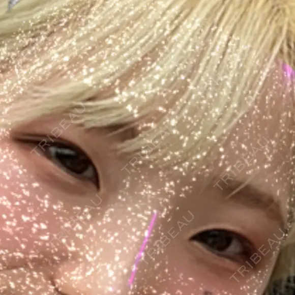 ヒアルロン酸注入（涙袋） 城本クリニック 長崎院 BEFORE メイン用