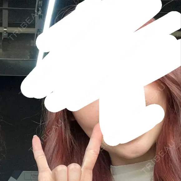 ボトックス（エラ・小顔） / ボトックス（肩） ルラ美容クリニック 横浜院 BEFORE メイン用