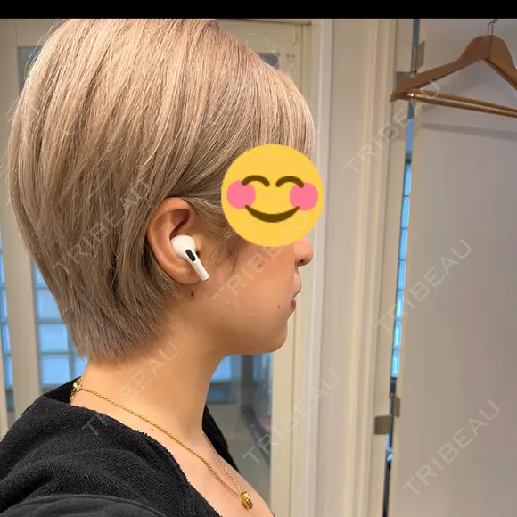 脂肪吸引（顔） お茶の水美容形成クリニック BEFORE メイン用