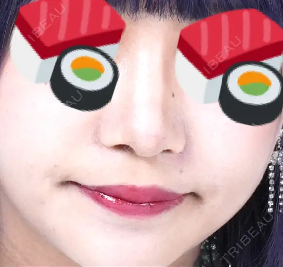 隆鼻術 / 鼻尖形成（切開） / 鼻中隔延長（切開） / 小鼻縮小（切開） / 軟骨移植 / 鼻尖縮小 R Beauty CLINIC 銀座院 BEFORE メイン用