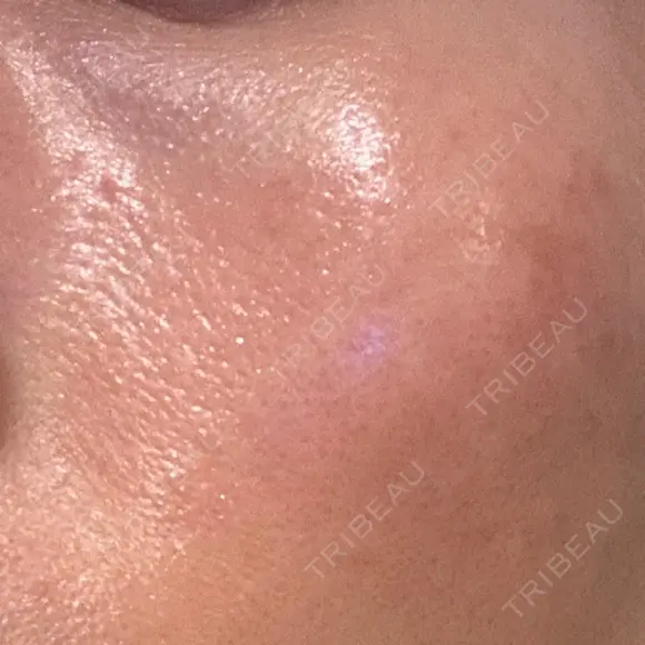 その他（肌） YAYOI CLINIC BEFORE メイン用