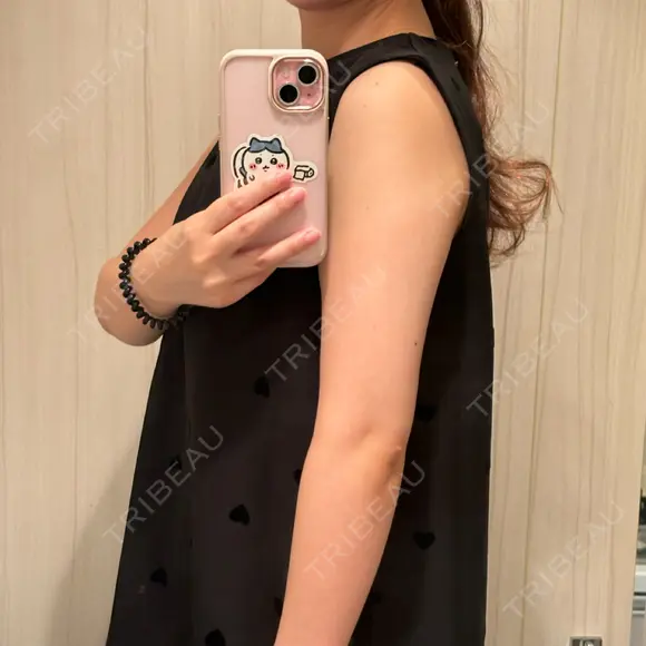 脂肪吸引（二の腕） 湘南美容クリニック 京都院 BEFORE メイン用