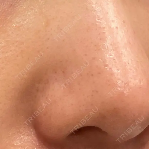 ポテンツァ 9BeautyClinic BEFORE メイン用