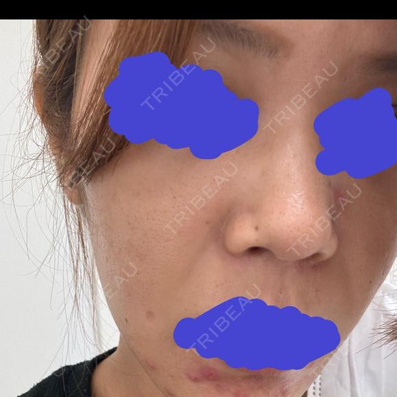 ポテンツァ NARU Beauty Clinic 【ナルクリ】 BEFORE メイン用