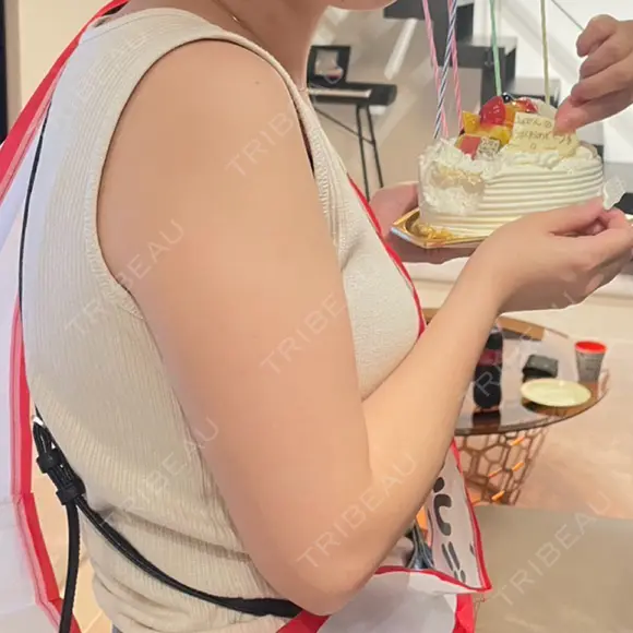 脂肪吸引（二の腕） 湘南美容クリニック 京都院 BEFORE メイン用