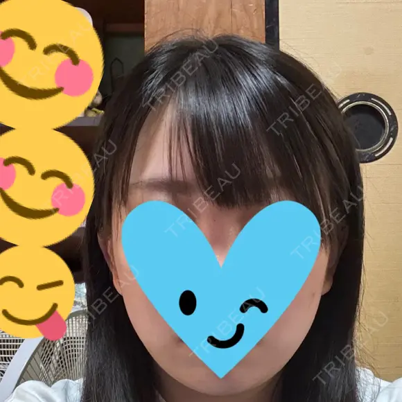 ボトックス（エラ・小顔） TCB東京中央美容外科 佐賀院 BEFORE メイン用