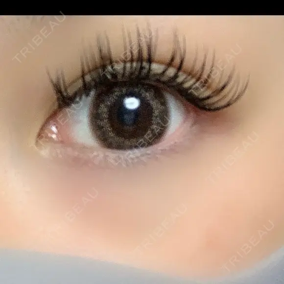 二重埋没 / ヒアルロン酸注入（涙袋） LOCHIC CLINIC GINZA【ロシッククリニック銀座】 BEFORE メイン用