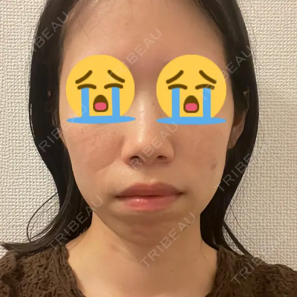 セットバック カトレア歯科・美容クリニック BEFORE メイン用