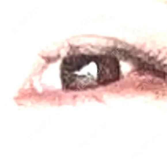 目尻切開 ヴェリテクリニック 大阪院 BEFORE メイン用