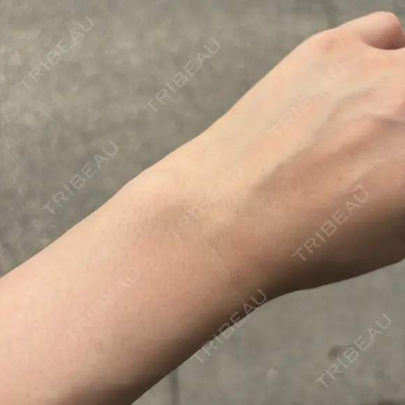 白玉点滴・注射 APOLLO BEAUTY CLINIC BEFORE メイン用