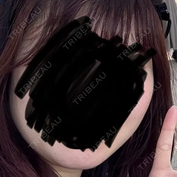 ハイフ（顔） 東京美容外科 名古屋院 BEFORE メイン用