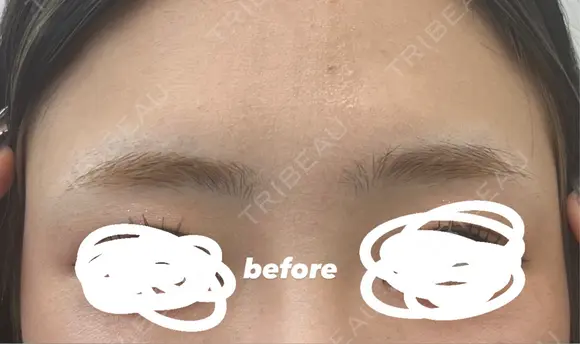 アートメイク（眉） セカジソウォン医院-明洞店 BEFORE メイン用