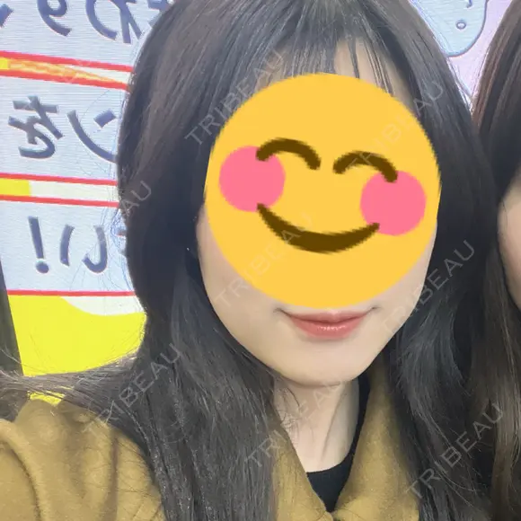 ボトックス（エラ・小顔） TCB東京中央美容外科 奈良院 BEFORE メイン用