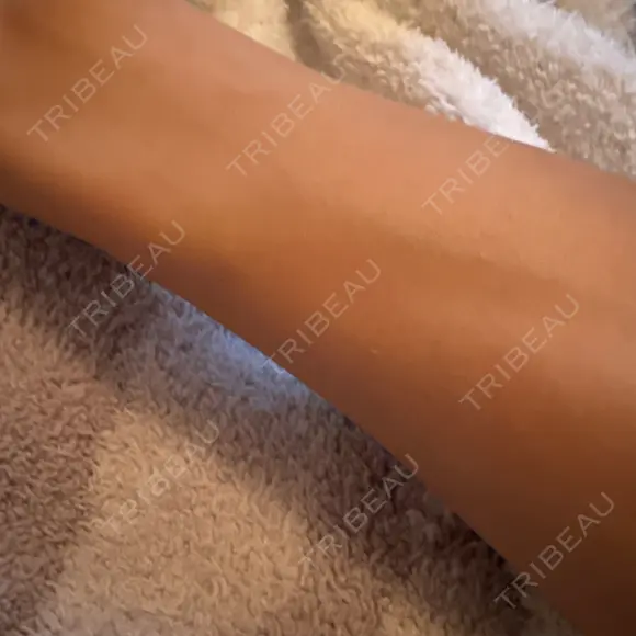 医療脱毛（全身） ジュエルクリニック 恵比寿院 BEFORE メイン用