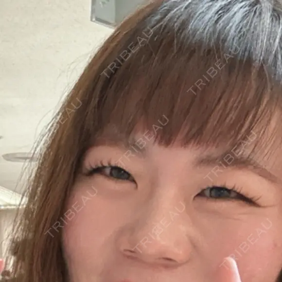 白玉点滴・注射 城本クリニック 福岡院 BEFORE メイン用