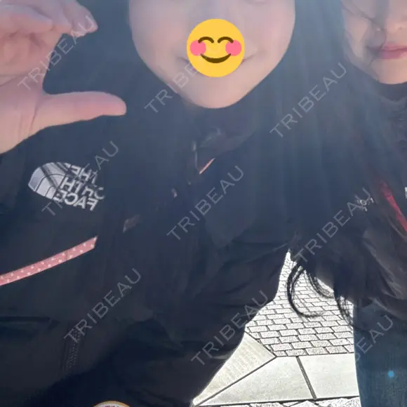 糸リフト / 脂肪吸引（顔） / 小鼻縮小（非切開） 形成外科と美容外科のクリニック池袋 BEFORE メイン用