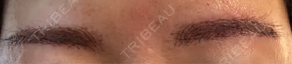 アートメイク（眉） 表参道メディカルクリニック 新宿院 BEFORE メイン用