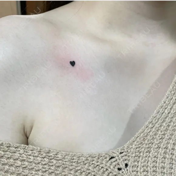 タトゥー除去 ziz CLINIC BEFORE メイン用