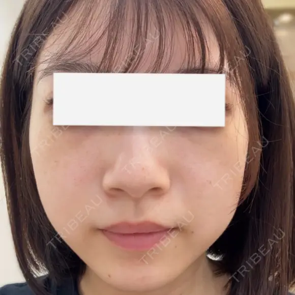 ルメッカ 大美会クリニック 天王寺院 BEFORE メイン用
