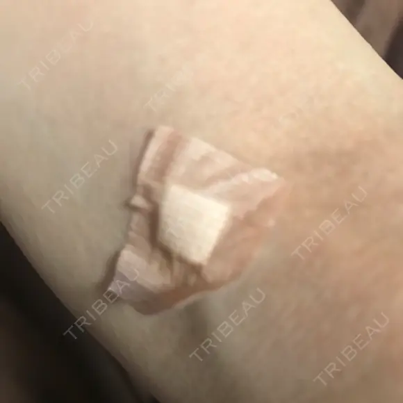 白玉点滴・注射 シン・整形外科 綱島 BEFORE メイン用