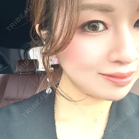 ヒアルロン酸注入（涙袋） アネシス美容クリニック BEFORE メイン用