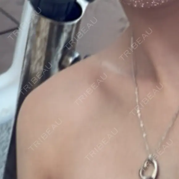 ボトックス（肩） / 高濃度ビタミンC点滴 小倉美容外科/美容皮膚科 ビラビューティークリニック BEFORE メイン用