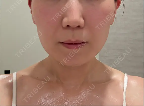 その他（肌） ルラ美容クリニック 仙台院 / ルラスキンクリニック 仙台院 BEFORE メイン用