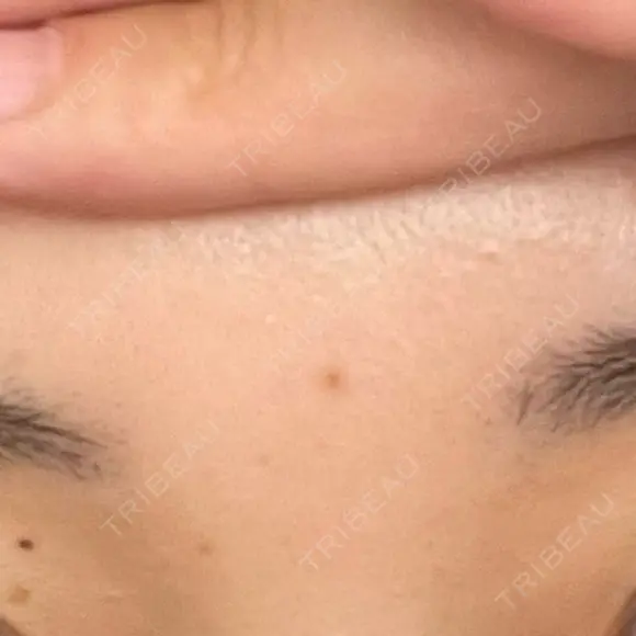 アートメイク（眉） 表参道メディカルクリニック 新宿院 BEFORE メイン用