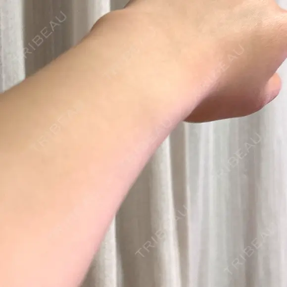 脂肪吸引（脚） / 医療脱毛（腕） 表参道メディカルクリニック 福岡天神院 BEFORE メイン用