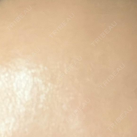 高濃度ビタミンC点滴 新宿美容外科ネビュラクリニック BEFORE メイン用