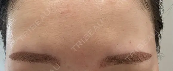 白玉点滴・注射 / アートメイク（眉） 表参道メディカルクリニック 名古屋院 BEFORE メイン用