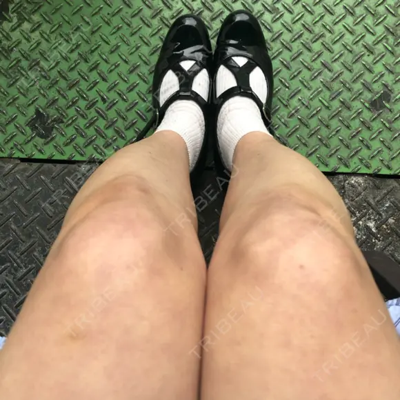 その他（ボディ） 加藤クリニック 麻布東京院 BEFORE メイン用