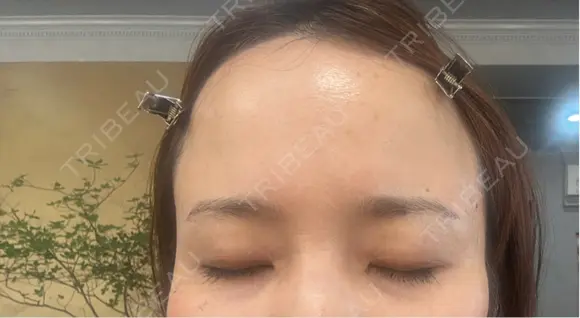 アートメイク（眉） 表参道メディカルクリニック 広島院 BEFORE メイン用