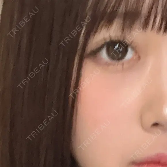 リジュラン 心斎橋KT美容クリニック BEFORE メイン用