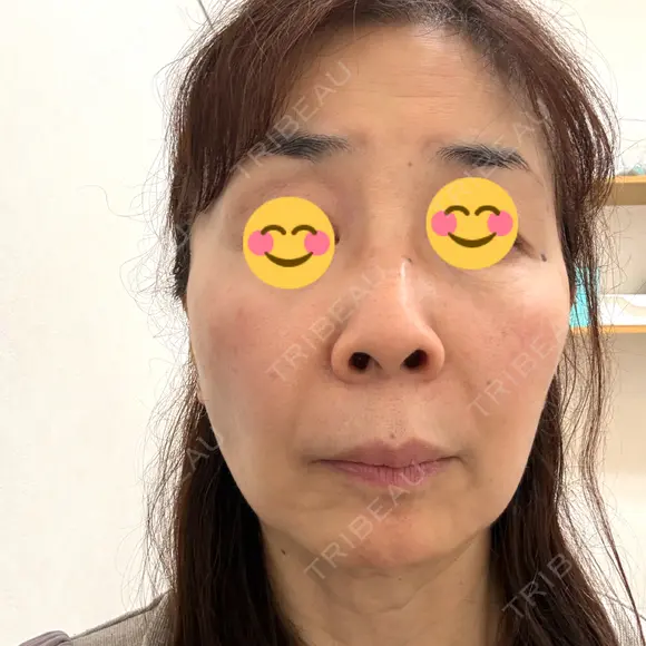 ポテンツァ BAO CLINIC 神戸院 BEFORE メイン用