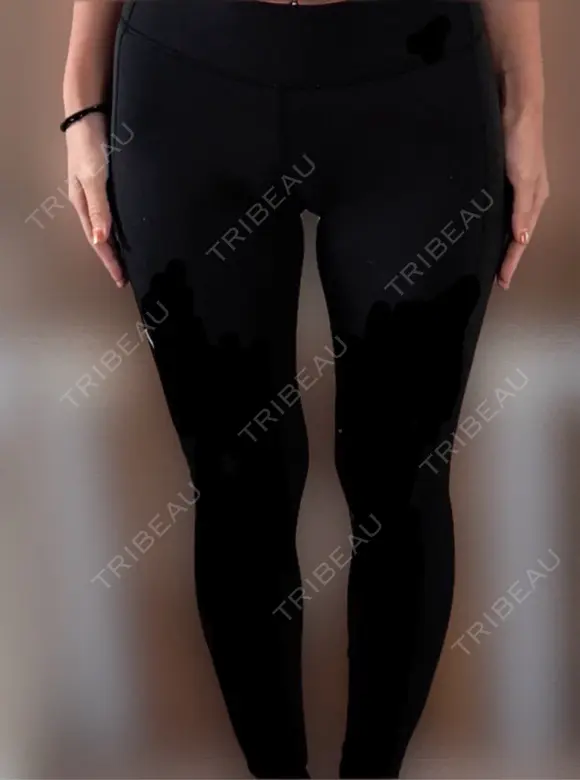 脂肪吸引（脚） / 脂肪吸引（お尻） アムルーズ美容外科クリニック 横浜院 BEFORE メイン用