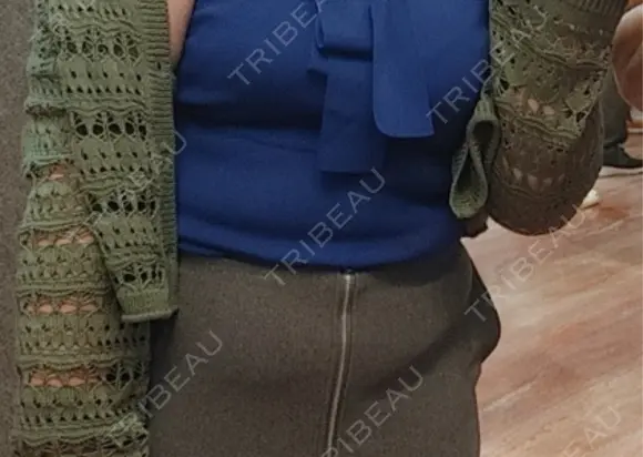 医療痩身（お腹） 渋谷美容外科クリニック 渋谷院 BEFORE メイン用