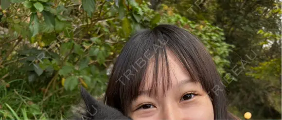 クマ治療 APOLLO BEAUTY CLINIC BEFORE メイン用