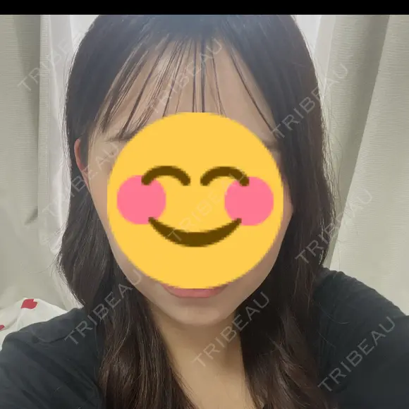 糸リフト / 脂肪吸引（顔） / ボトックス（エラ・小顔） Wing clinic 豊中駅前院 BEFORE メイン用