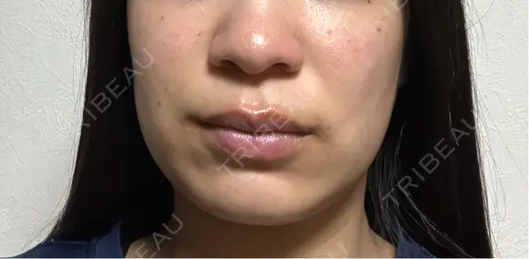 オンダリフト RIVER CLINIC（リバークリニック） BEFORE メイン用