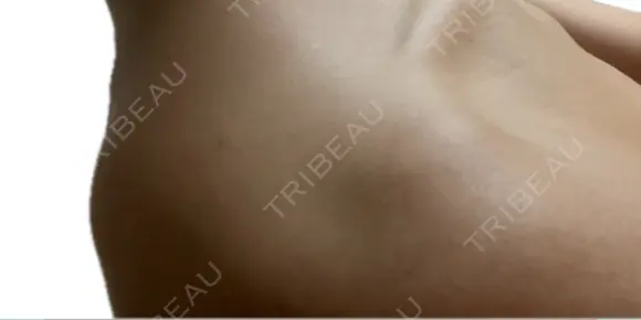 プラセンタ注射 新宿駅三丁目クリニック BEFORE メイン用