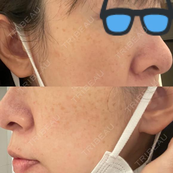 ルメッカ Evergreen medical clinic BEFORE メイン用